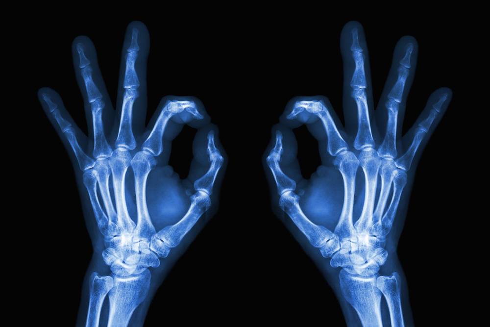 Xray